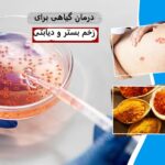 درمان گیاهی زخم بستر و زخمهای دیابتی