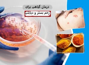 درمان گیاهی زخم بستر و زخمهای دیابتی